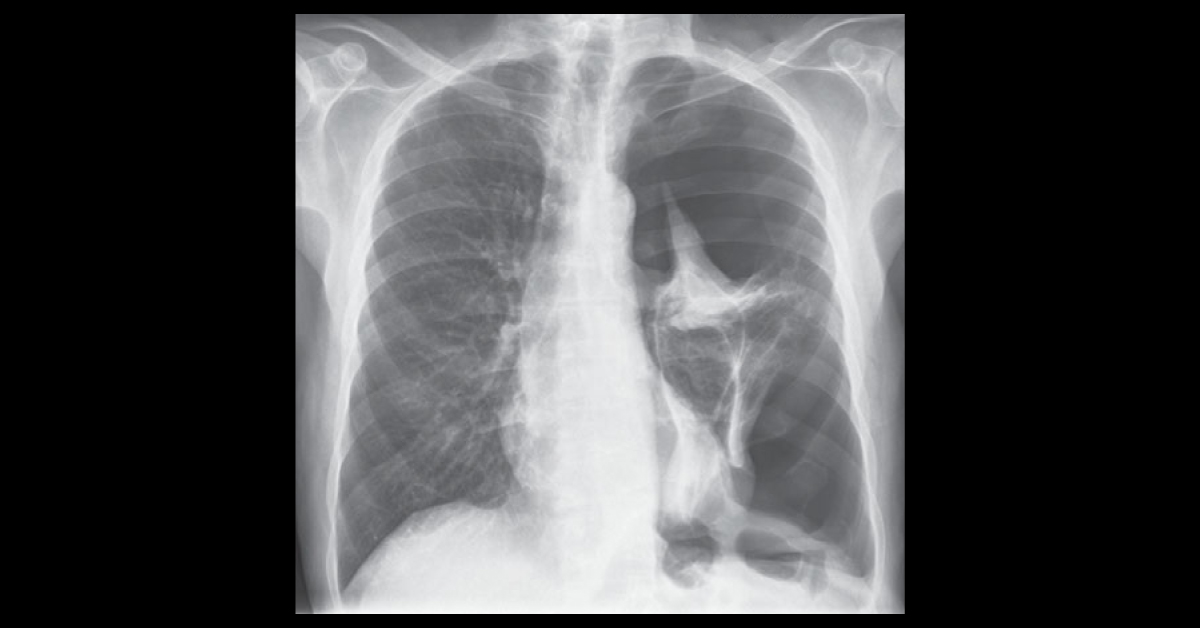 Diagnose From This Radiograph