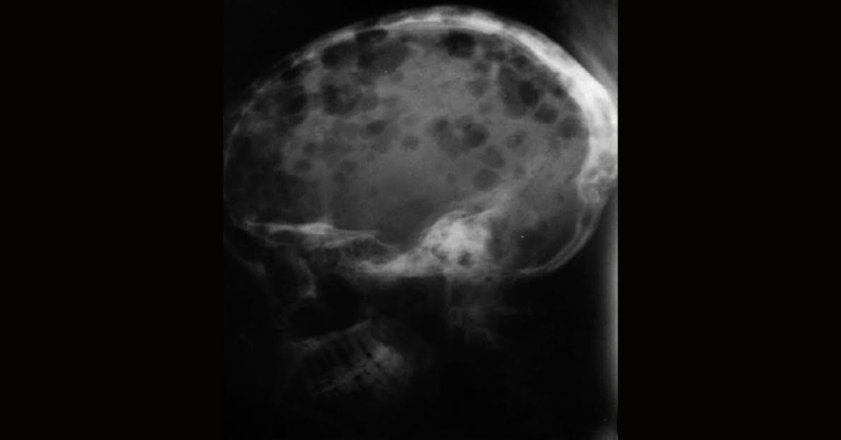 Interpret The  Radiological Findings
