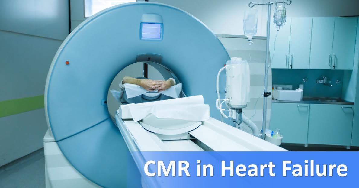 Cardiovascular Magnetic Resonance In Heart Failure