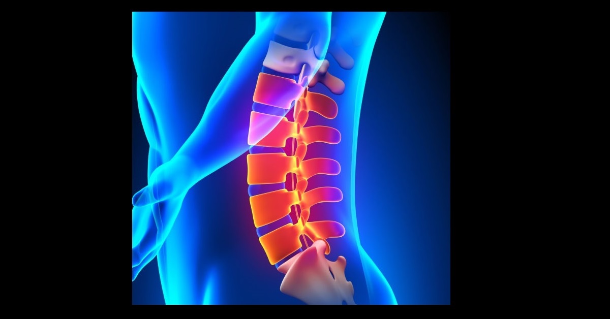 Conservative Management Of Lumbar Spinal Stenosis