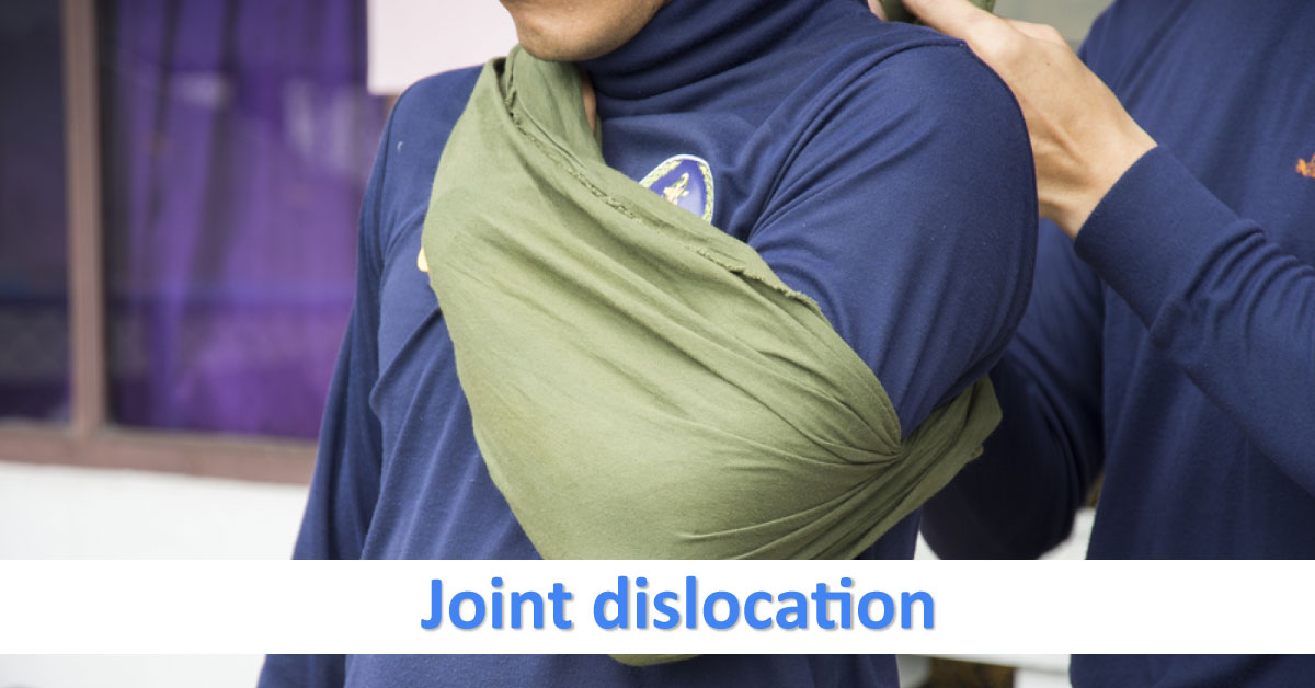 Common Dislocations In Sports