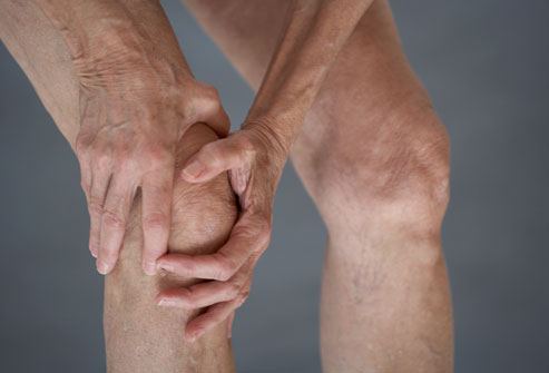 Osteo Arthritis- Newer Preventable Etiologies