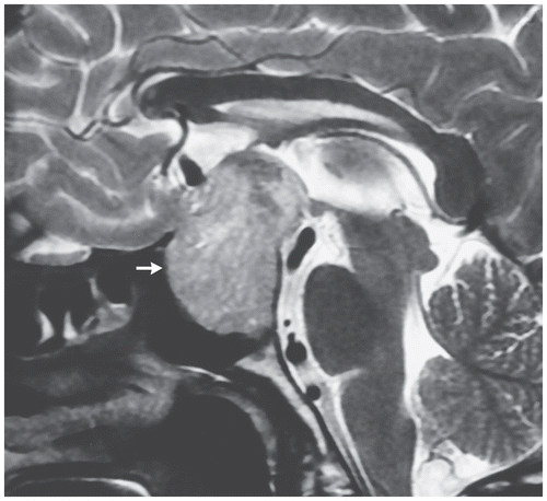 Identify This Ophthalmic Condition
