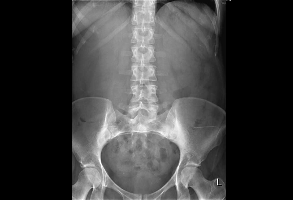 Give Your Diagnosis
