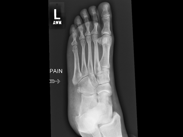 Solve This Orthopedic Case