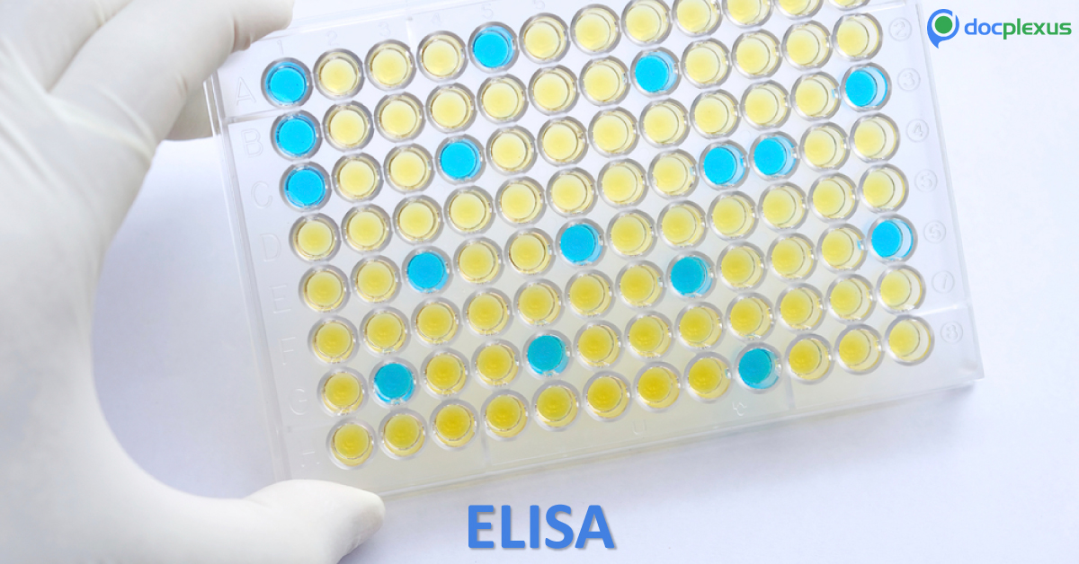 New Test Distinguishes Zika From Similar Infections