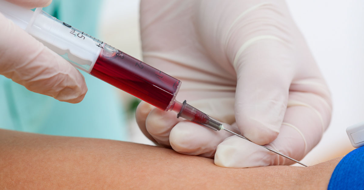 Simple Blood Test To Identify Risk Of Cardiac Event After Orthopedic Surgery