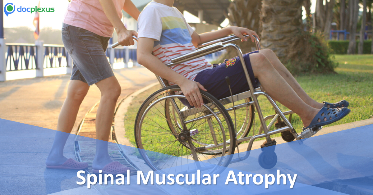 Nusinersen For Spinal Muscular Atrophy