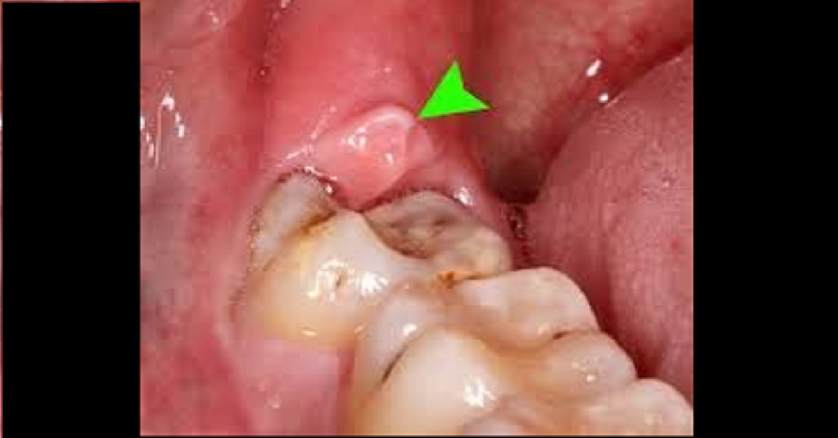 What is your diagnosis?