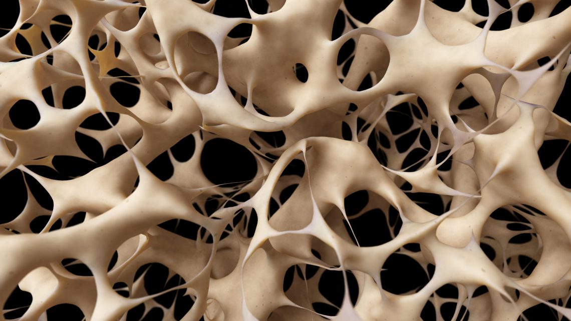 Juvenile Osteoporosis, An Insight