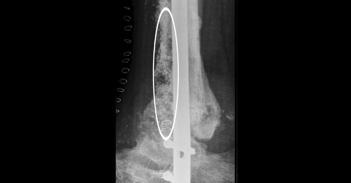 Identify The Abnormality?