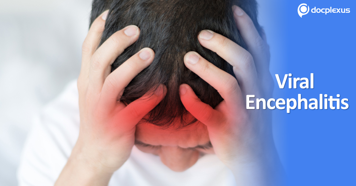 Management Of Viral Encephalitis