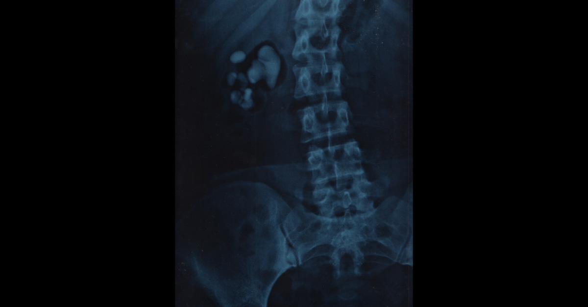 Spot The Diagnosis
