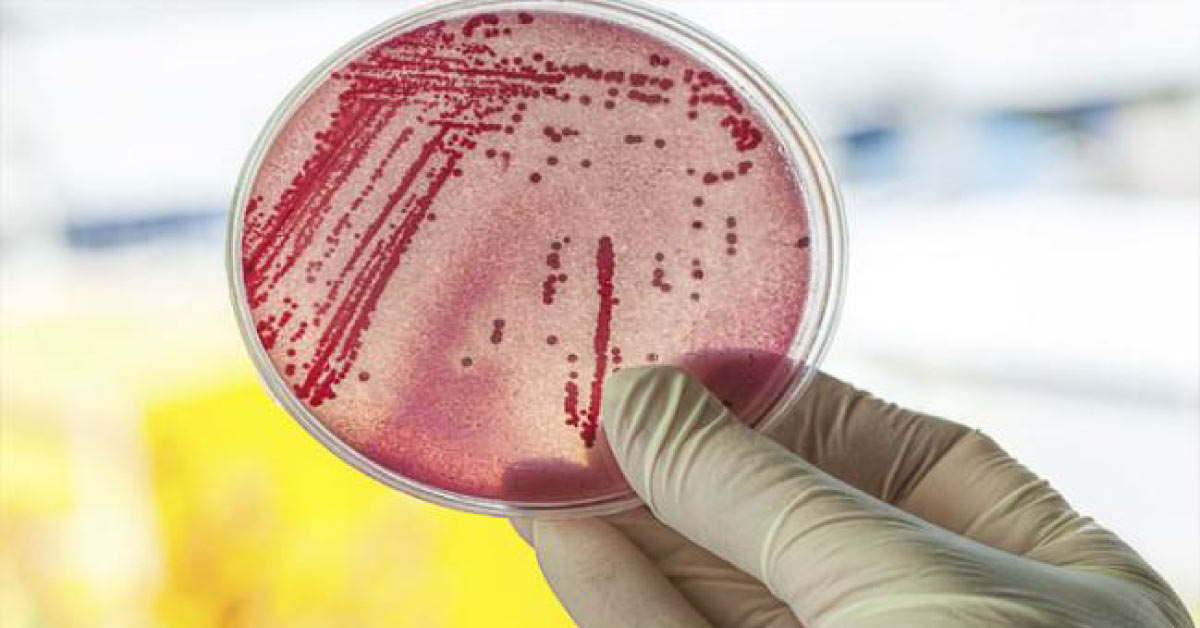 Simple Bacteria May Prevent Sepsis Which Kills Thousand- Research By Odisha Doctor