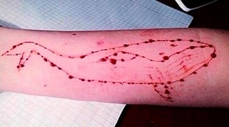 Blue Whale Challenge: A Self- Harming Game Killing Youth