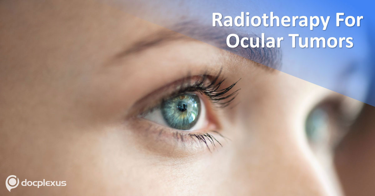 Applications Of Radiotherapy In Ocular Tumors