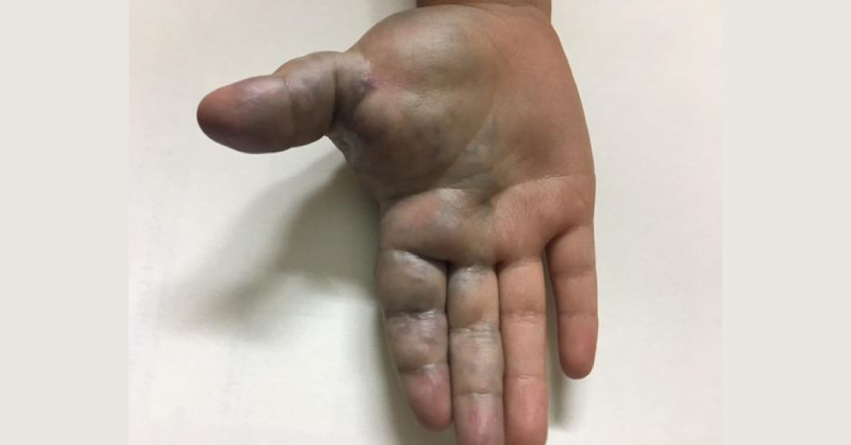 Diagnose The Lesion