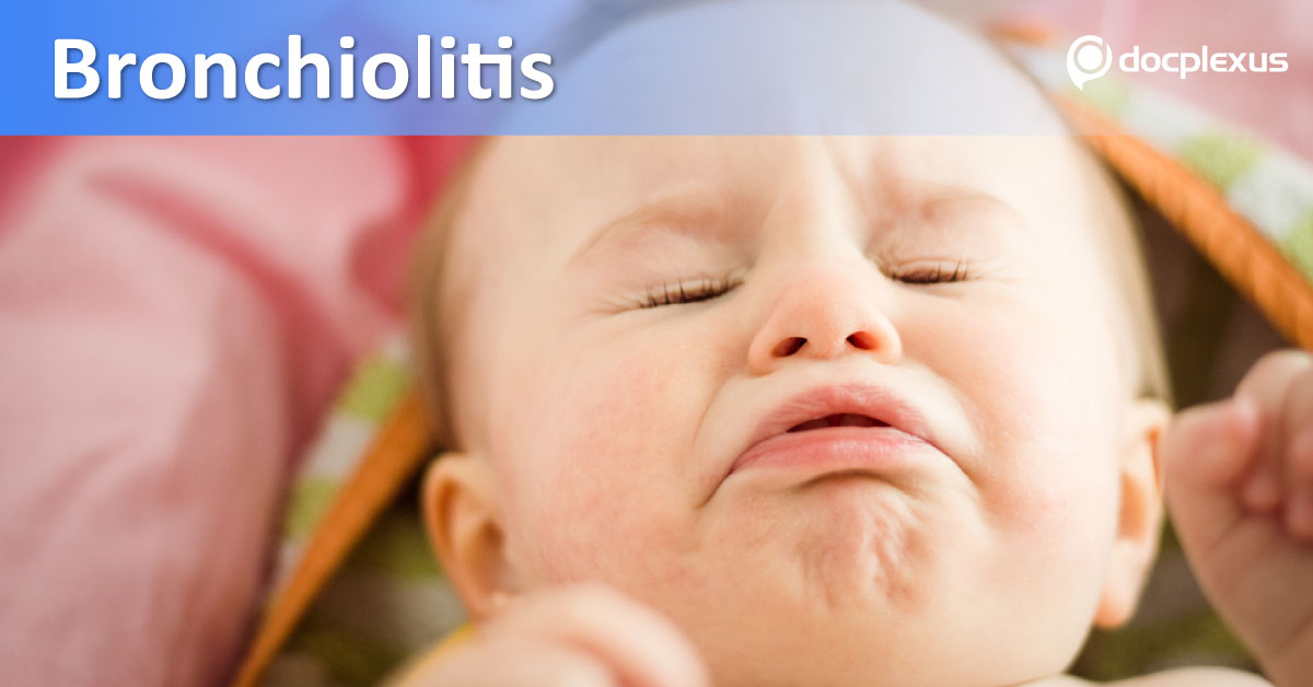 Do’s And Don’ts For Treatment Of Pediatric Bronchiolitis