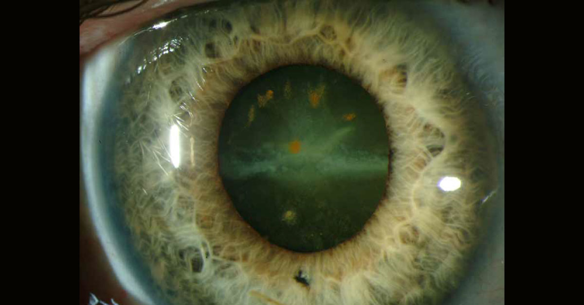 Identify The Condition