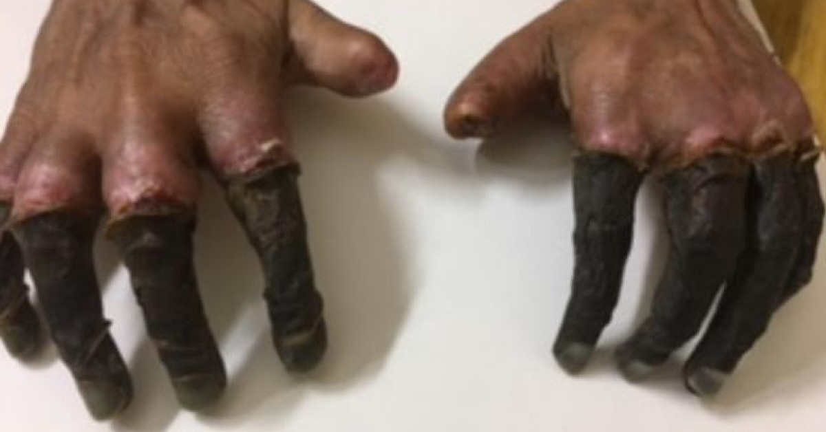 Diagnose This Condition