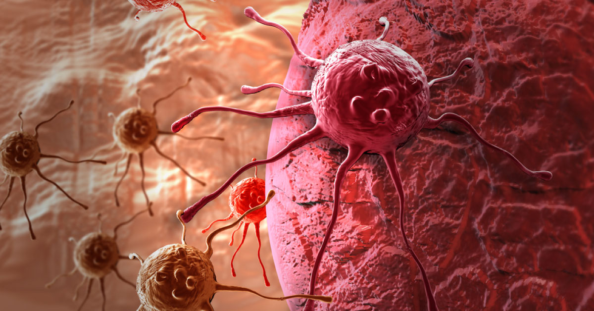 New Drug May Inhibit Cancer Cell Growth Of Brain, Liver, Colon
