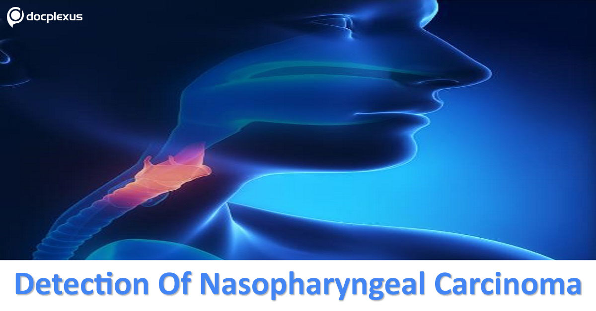 Early Detection of Nasopharyngeal Carcinoma