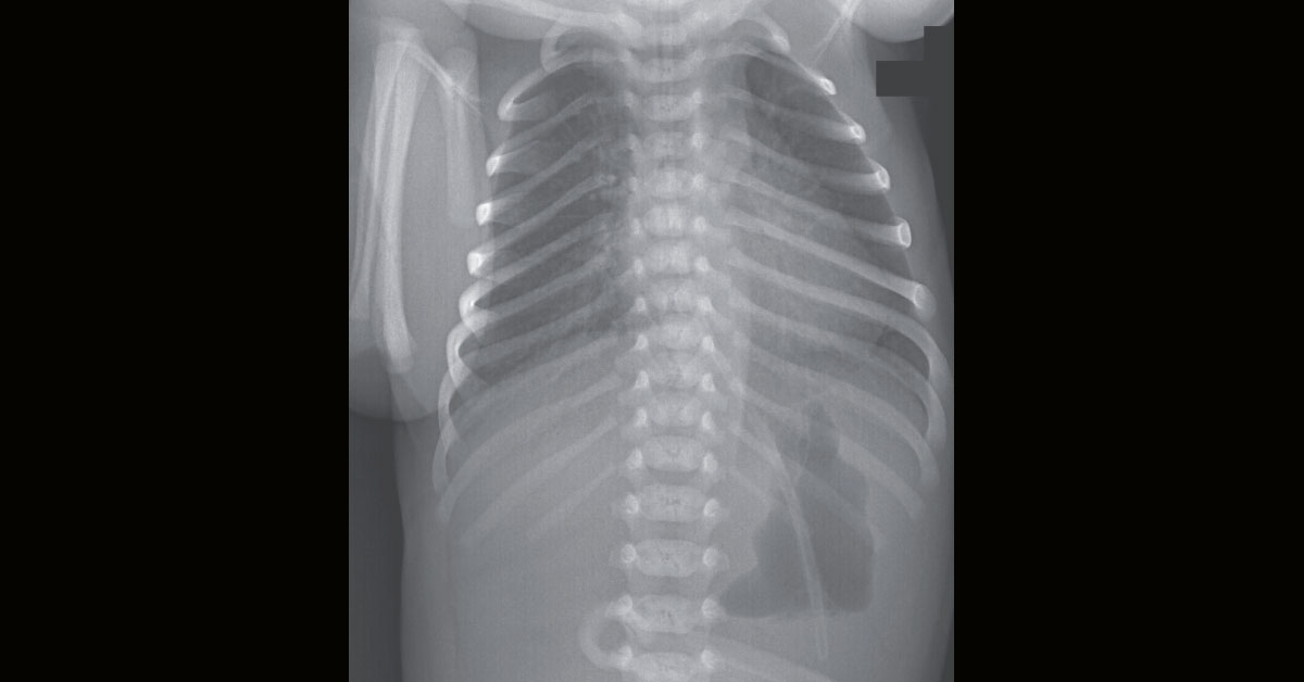 Identify This Condition In An Infant