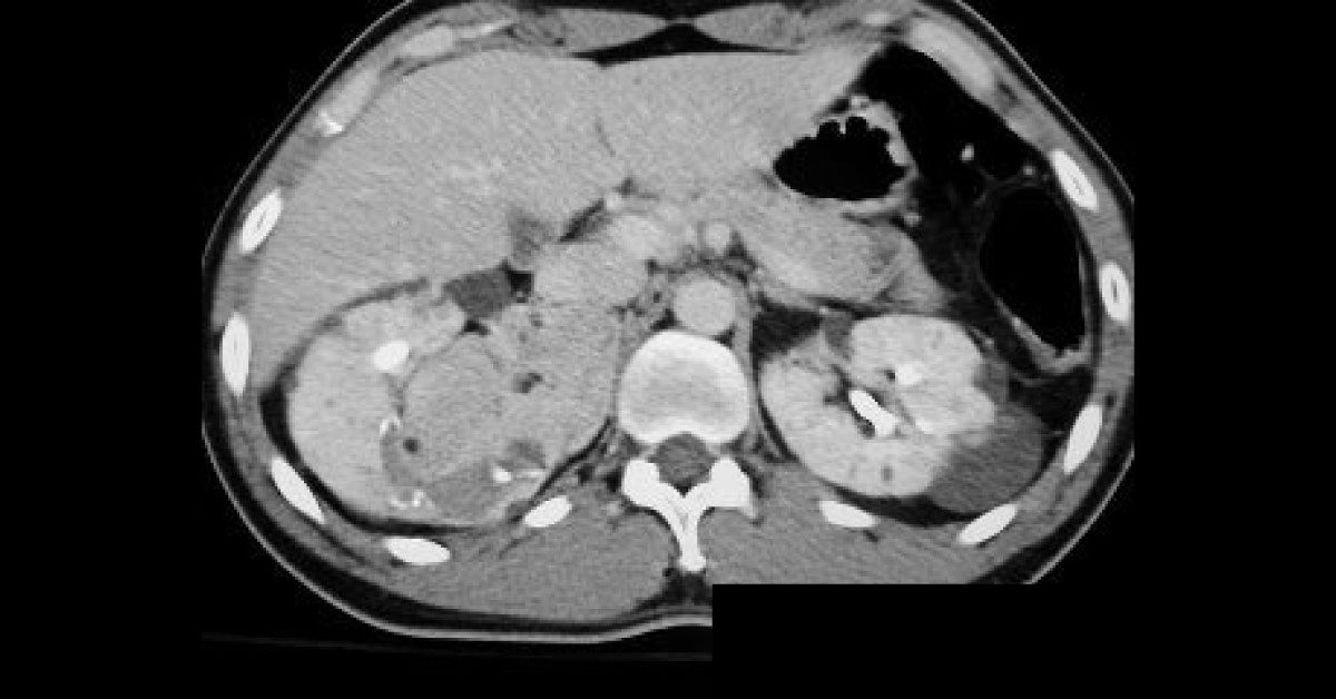 Image Based Diagnosis