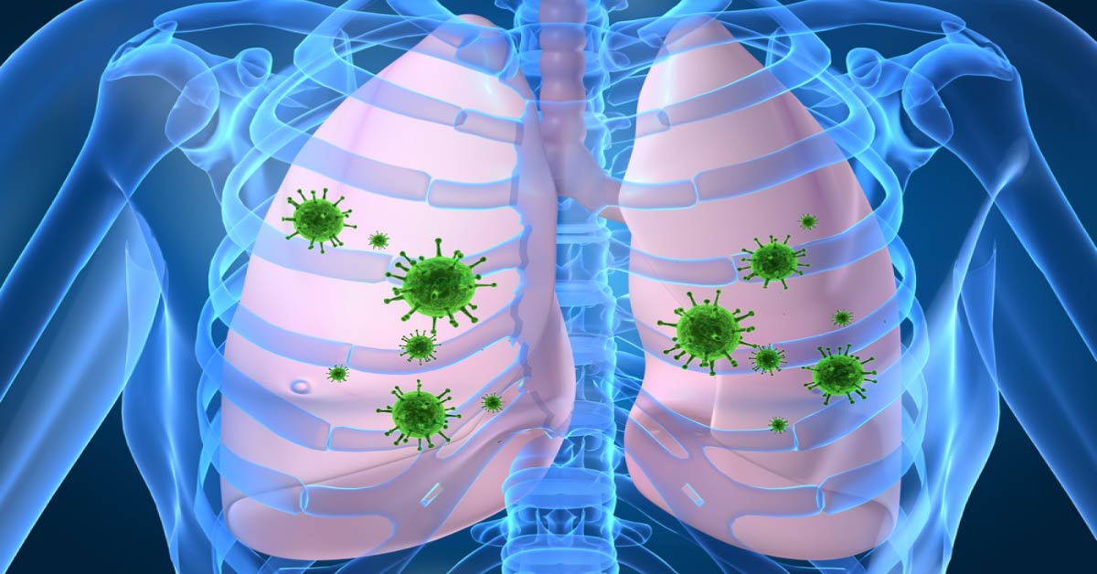 Study Of Prevalence Of HIV Infection And Its Clinical Profile Among Tuberculosis Patients