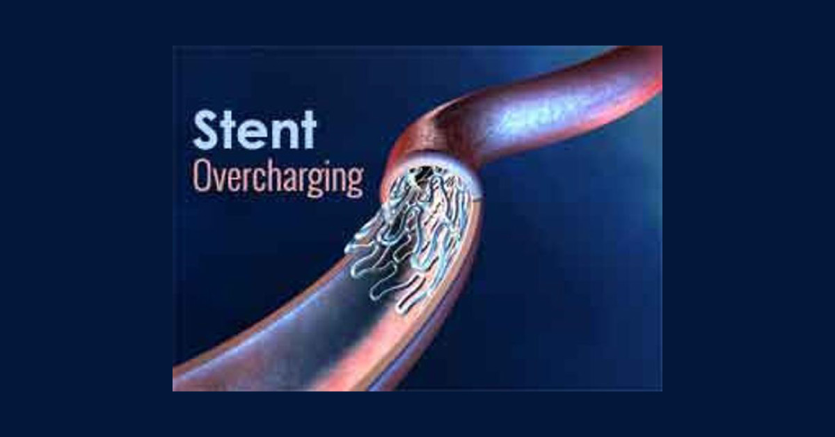 Doctors Be Ready To Pay Cost For Overcharging The Patients For Stents