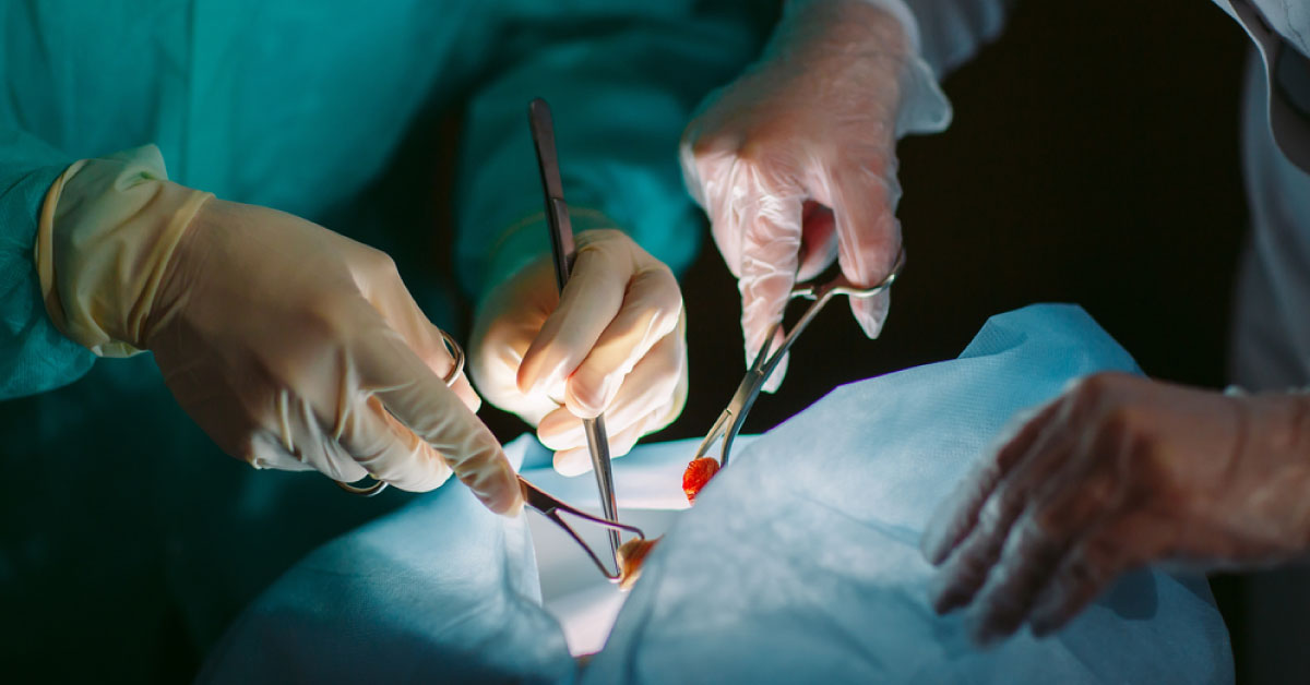Even Handed Future Of Surgery –Ambidextrous, Serious Gamers With Innate Left Hand Laterality