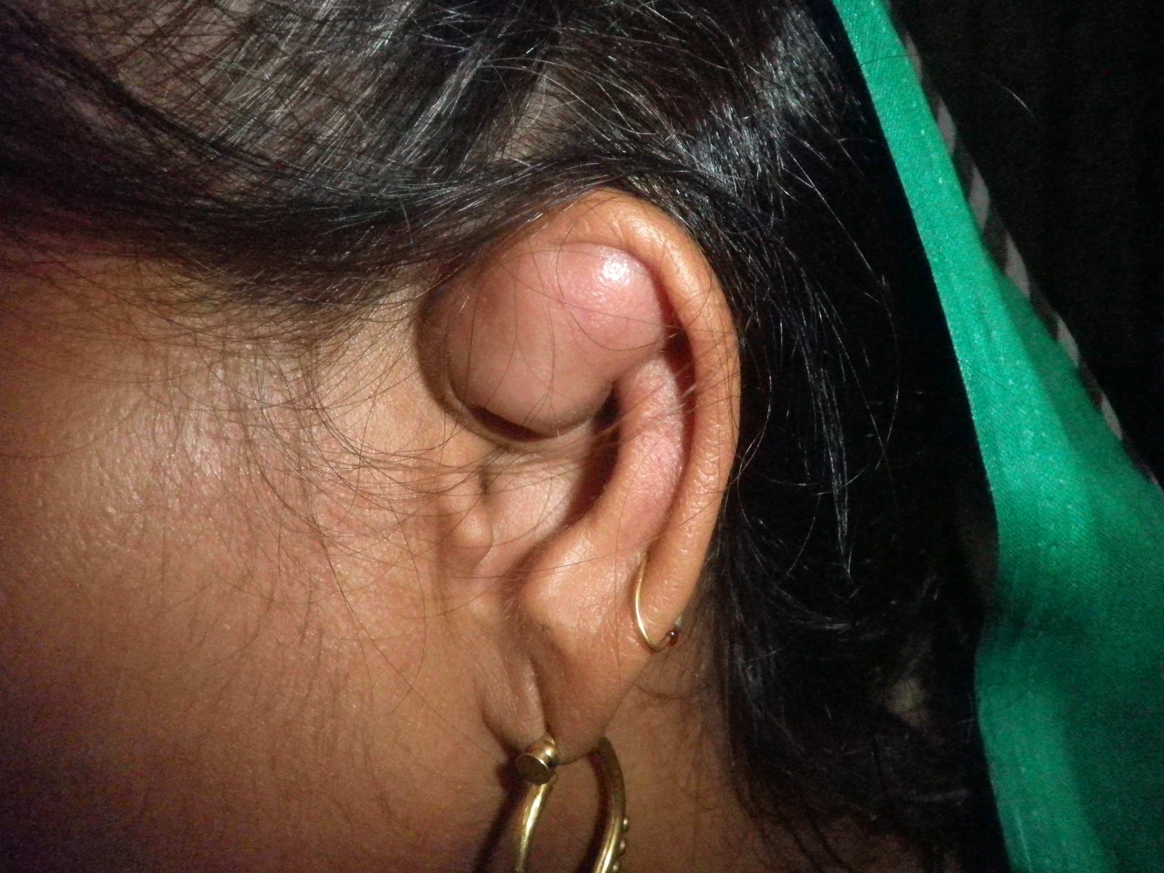 Identify The Lesion And Management Of Case