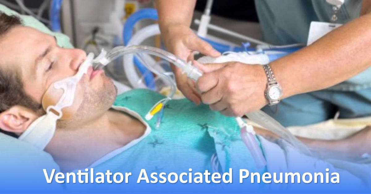 Technology to Prevent Pneumonia in ICU
