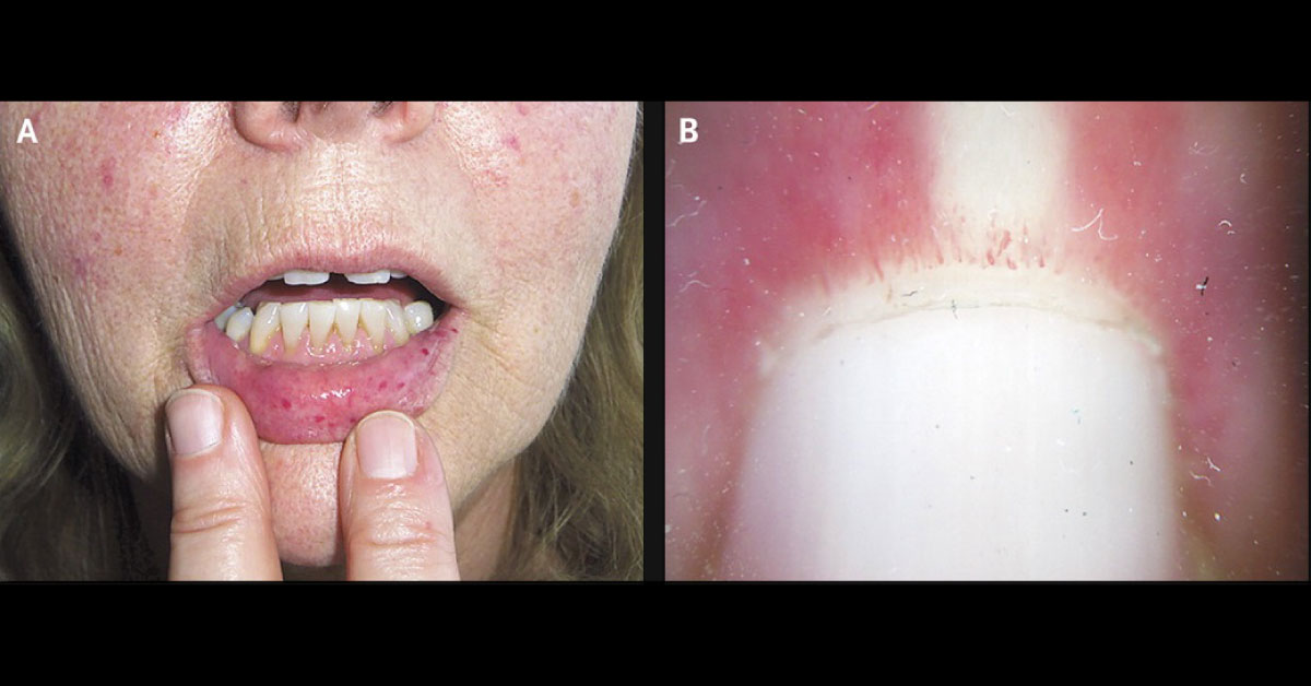 Identify This Condition In An Elderly Woman