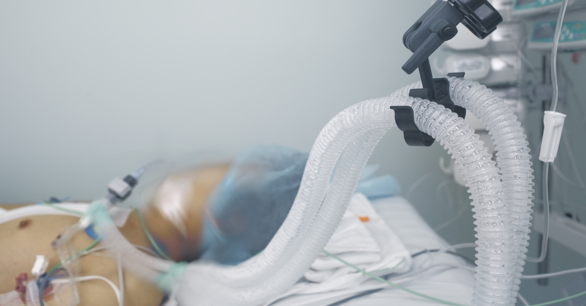 Dexmedetomidine Complications When Large Doses Are Used, Measures To Be Taken