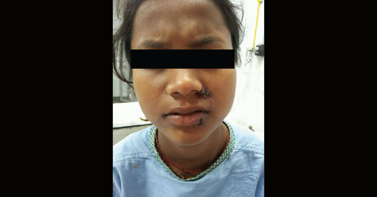 Solve This ENT Case