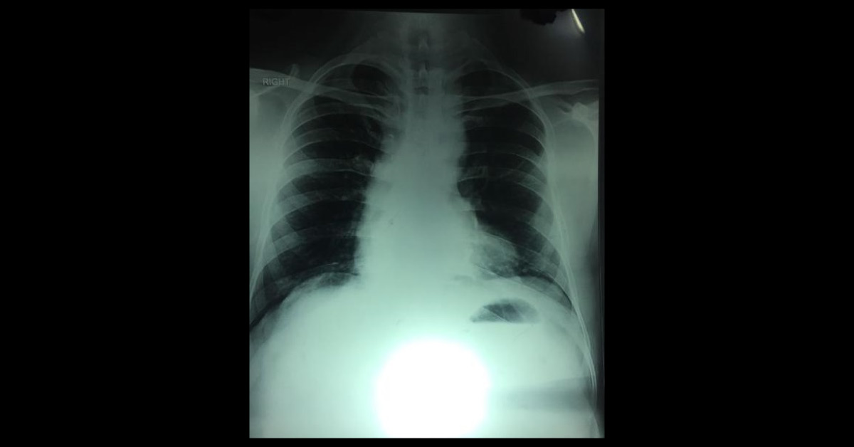 Diagnose The Chest X-ray