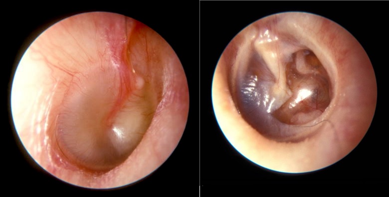 Resolve This ENT Case