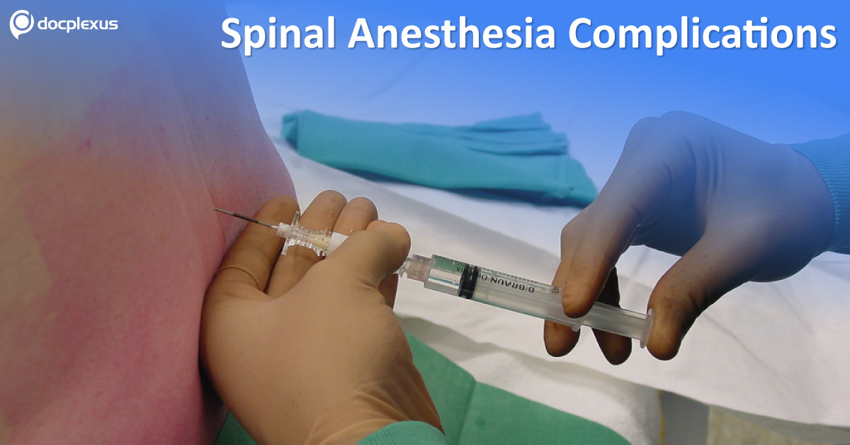 Spinal Anesthesia: Managing Complications