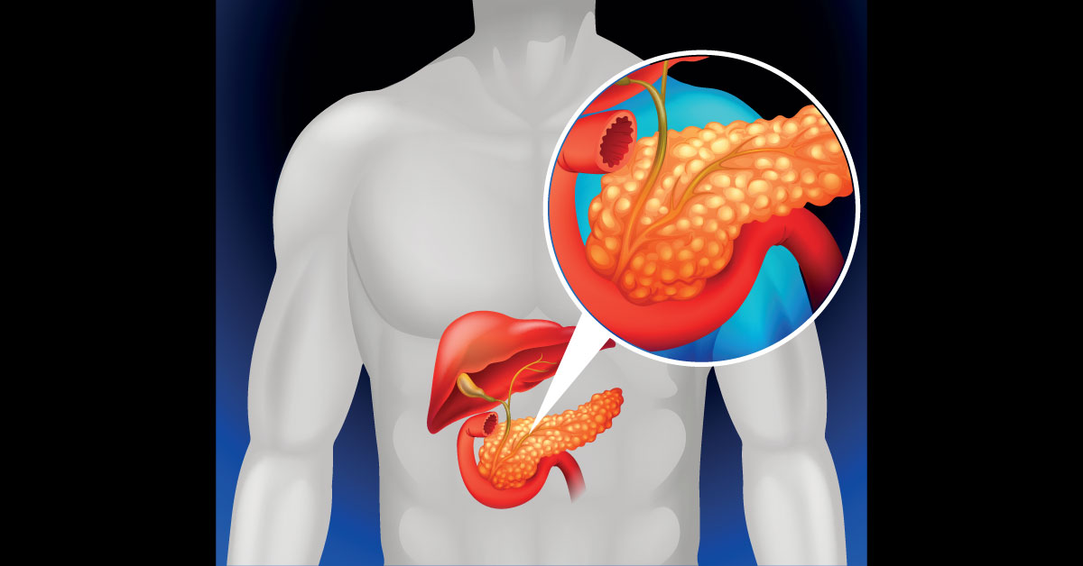 A Selfie Can Diagnose Pancreatic, CBD, Liver Cancer Or Diseases