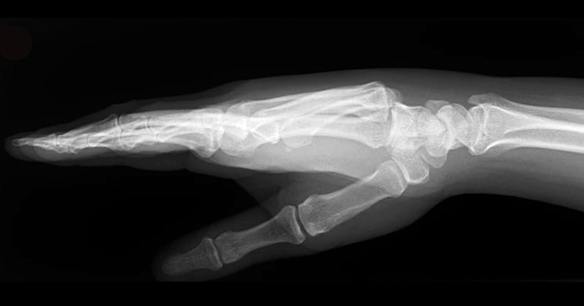 Diagnose From The Radiograph