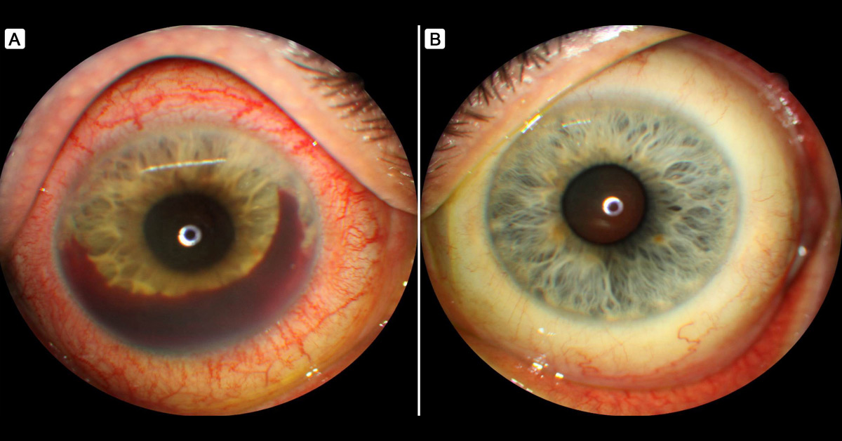 Diagnose The Eye Problem
