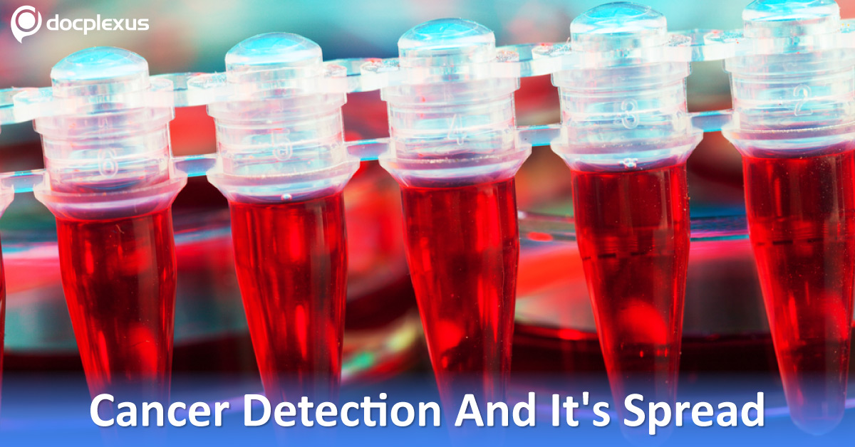 New Cheap Blood Tests To Detect Cancer And Its Spread