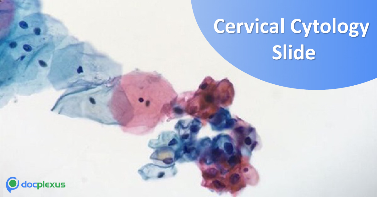 Give Your Opinion On This Gynecology Case