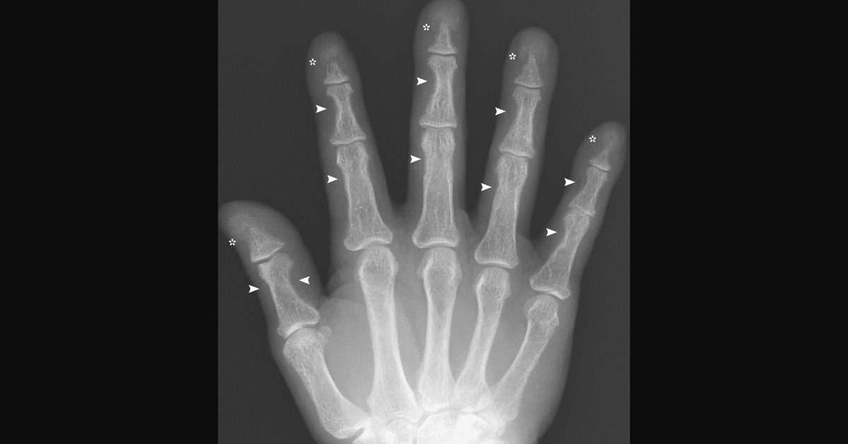 Identify This Condition In A Man