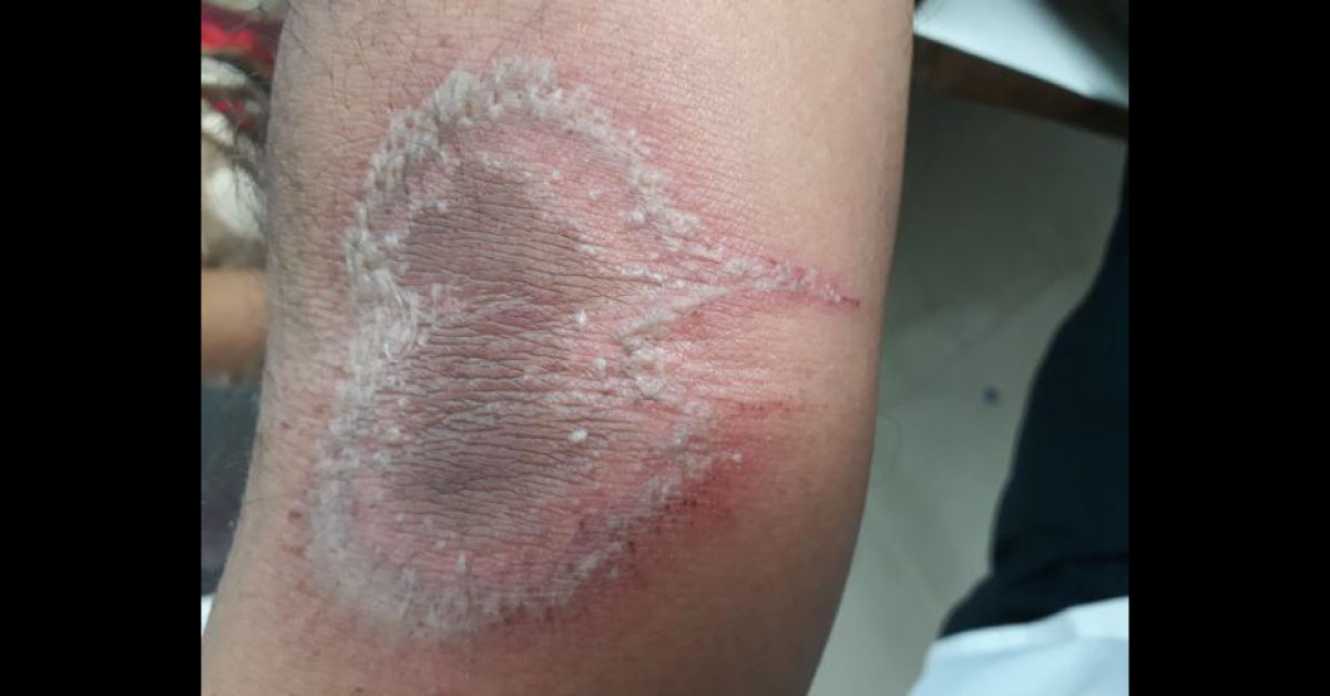 Spot The Diagnosis