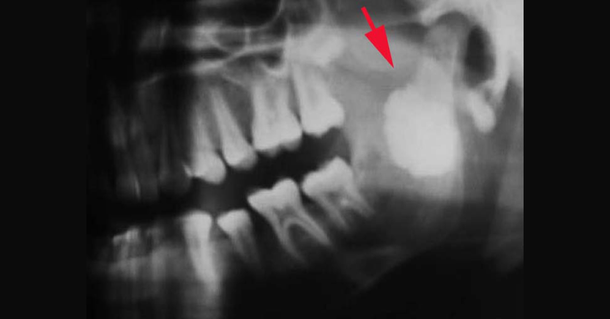 Spot The Condition