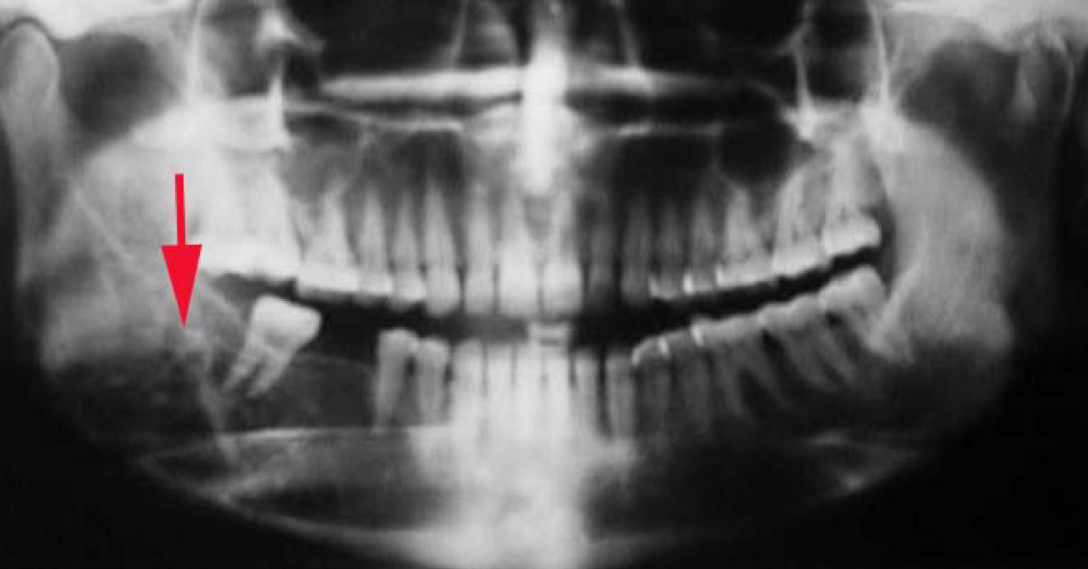 Identify This Abnormality