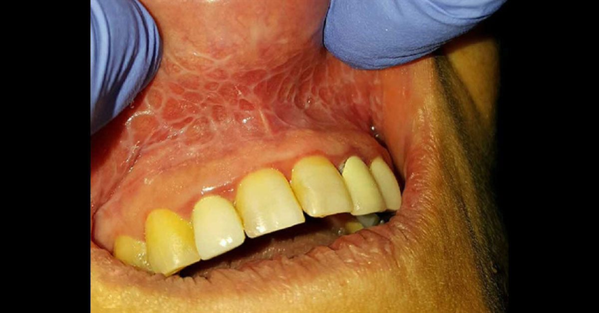 Identify This Condition