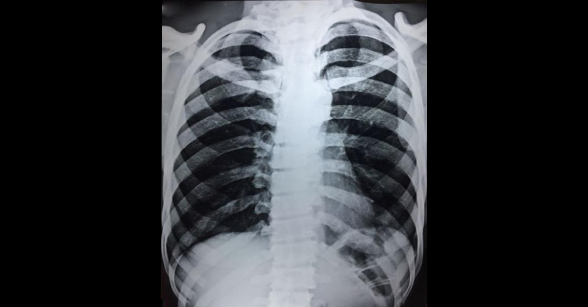 Help Diagnose The Condition